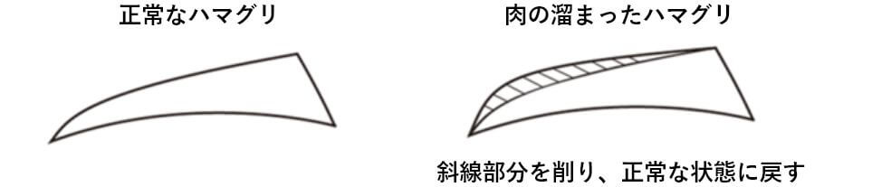 刃を薄くする（肉抜き）の画像